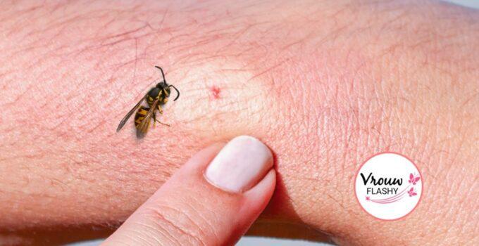 Wespensteek 7 tips om ze te voorkomen en 10 tips tegen de pijn